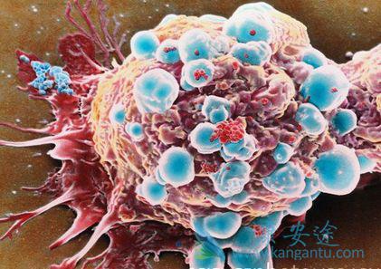 海外医疗 海外医疗