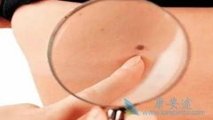 ����ҽ�Ƹ�������Ϊʲô����ݱ��Ϊ��ɫ������