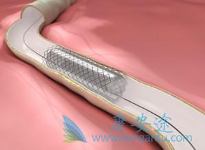 海外医疗 海外医疗