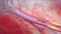 ����ҽ�Ƶ��Ĵ��ɽ�������֧��Ϊʲô��ô�ܻ�ӭ��