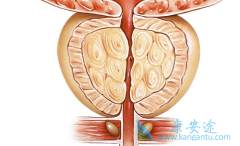 ���޿�(ERLOTINIB)ά�������Ǳ����������ƺ�ֱ��������һ����ѡ