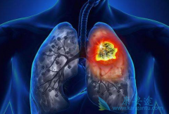 ��������(GRLONAT)����mTOR���Ƽ���άĪ˾�����������ڷΰ���