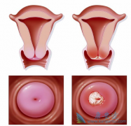 ���޿�(GRLONAT)����˳������Ϊ���ֹ��������ߵĳ����Ʒ�