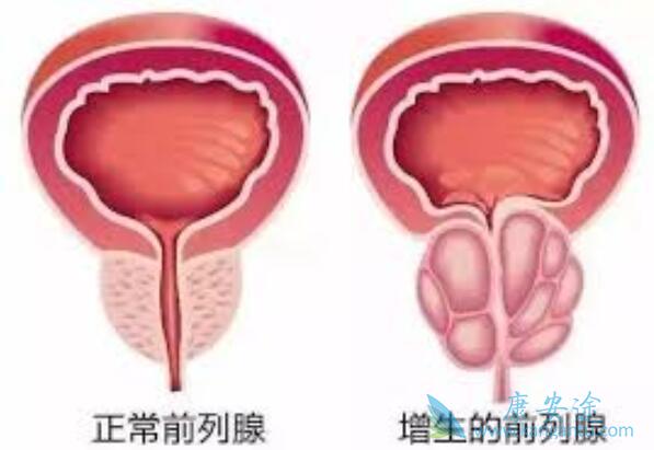 ǰ���ٰ�����