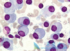 �˽�෢�Թ�������֢״�ɰ����������շ��ֲ���