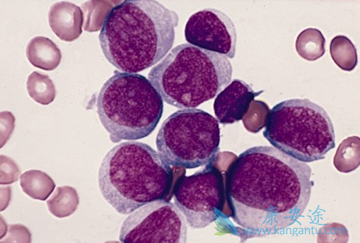 ��Ѫ����Ⱦ��