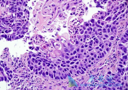 ����״ϸ����