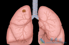 ���˻������Ʒΰ��ķ�������ʲô����ʲô���ƣ�