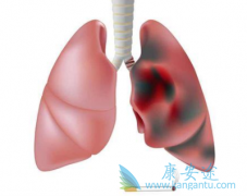 ������֢״��Сϸ���ΰ���ת�Ƶķ�������Щ