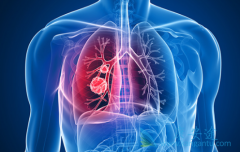 ӡ�����޿�/���������Ǻܶ��ο�ȥӡ��ҽ�����ε���Ҫԭ��