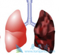 ��������(afatinib)��һ���ΰ�ҩ������ǿ�ȸ���