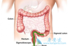 �����������ƺ��չ�Ľ�ֱ�������߿ɷ��ð�������