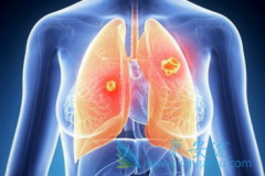 ����ALK���Է�Сϸ���ΰ��İ���ҩ���м��֣����߸���ôѡ��