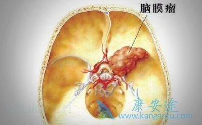 ��Ĥ������