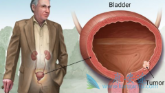 ���װ�����������ǰ���л��ƿ��Ը�����������