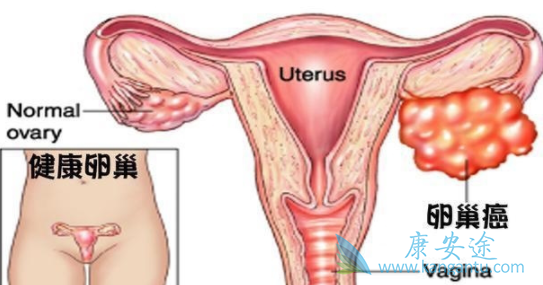 尼拉帕尼 尼拉帕尼