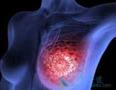 ���ٰ����Ʒ�����ôѡ��CDK4/6���Ƽ��������������ٰ���ҩ��