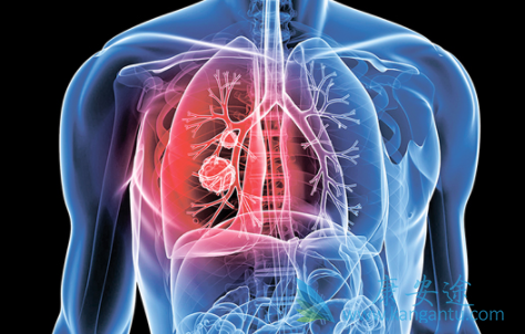 �ΰ�����