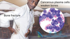 �෢�Թ�������ҩSelinexor�ѻ��FDA�¶�ҩ����ͨ���ʸ�