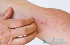 ��΢���޿�������Ƥ����δ�������ʣ�