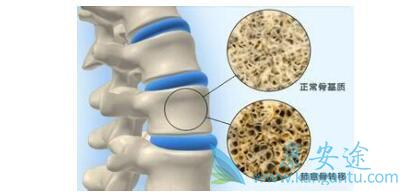 �ΰ���ת��