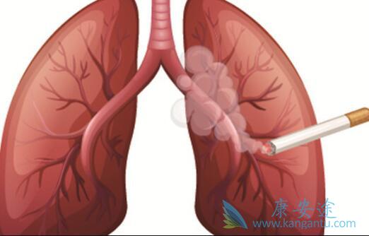 小细胞肺癌 小细胞肺癌