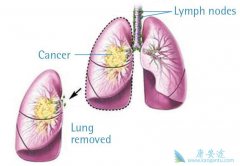 Сϸ���ΰ����Сϸ���ΰ������Ʒ����кβ�ͬ��