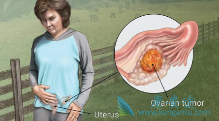 复发性卵巢癌 复发性卵巢癌