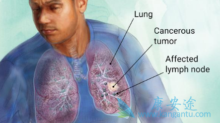 ���ڷ�Сϸ���ΰ�