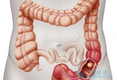 �����鵥���Ͱ�������ά�������е�Ӧ���о�