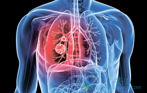 �ΰ�����