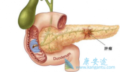 ���������Ͱ׵�����ɼ�����������ٰ������ƻ�ʯ