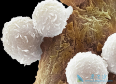 PARP���Ƽ���Ϊ���ư�Ѫ������ϣ��