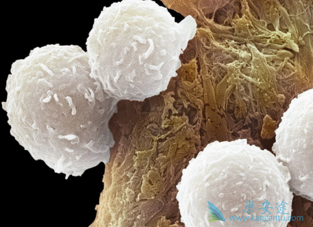 ���ư�Ѫ��