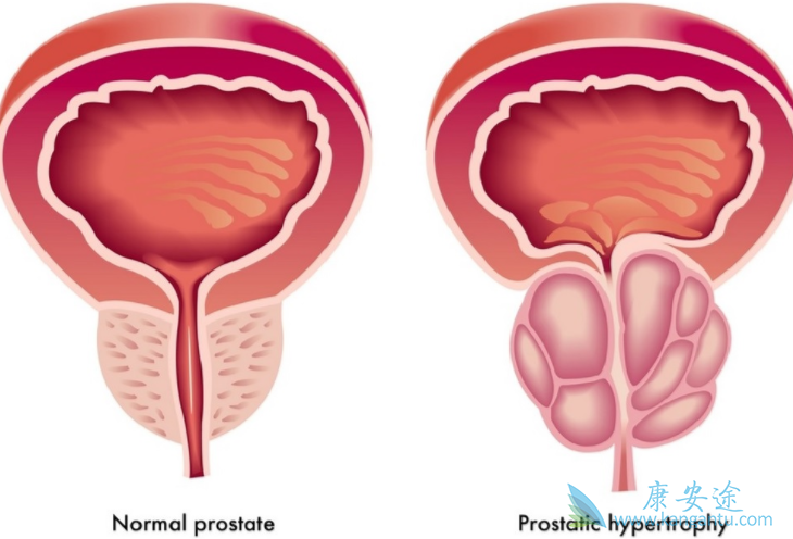 ǰ���ٰ��ܻ���