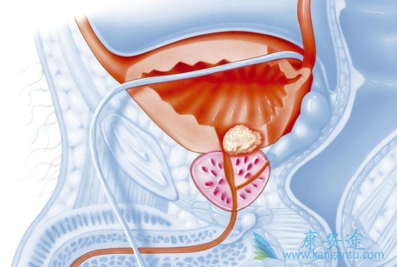 ǰ���ٰ�����