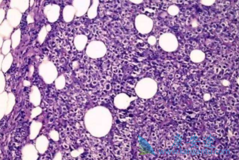 �����Դ�Bϸ���ܰ���