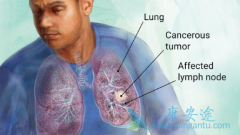 PARP���Ƽ���Сϸ���ΰ�����������о���չ