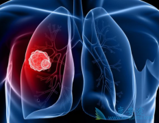 ��������(Alunbrig)���һ��ALK���Ƽ����и��õ�­����Ч