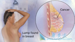 HR+���ٰ����߳������ڽ�/Զ�ڵĸ���ת�Ʒ���