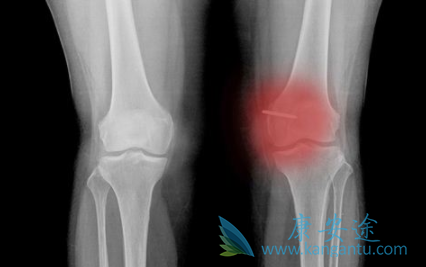 ��ά����