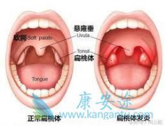 �����尩���շ���������Щ��֢״��������Щ��