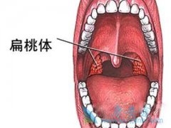 ���ڱ����尩���ٴ��ź�����Щ��