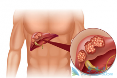 �ΰ����Ʒ������ѡ�����������ʺ�ʲôʱ���ã�