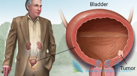 ��֢������