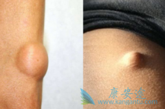 ��̹/��������������Ϊ���������Ķ�����ҩ