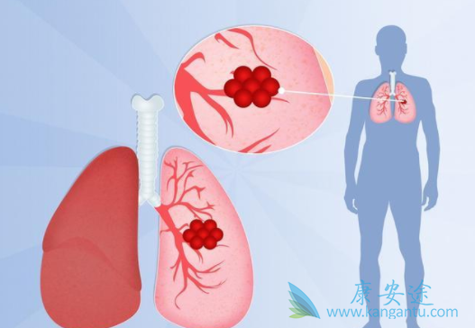 �ΰ�������ǰ֢״