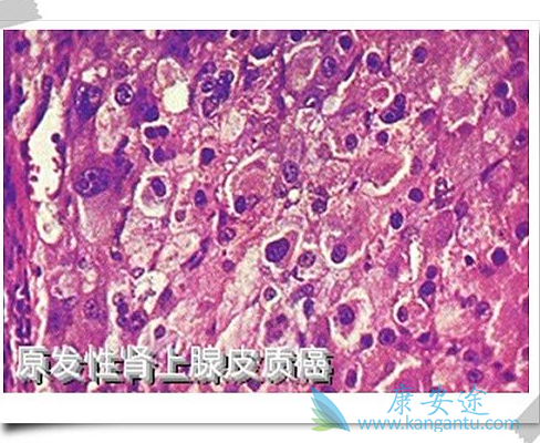 ������Ƥ�ʰ�