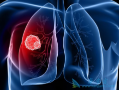 ��EGFR���Ƽ������������ڷΰ�ʱ���ٵ����⣿