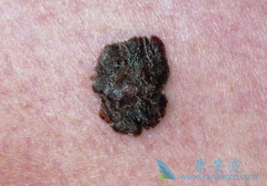 ʲô�Ǻ�ɫ�������շ���ɫ��������������Щ��